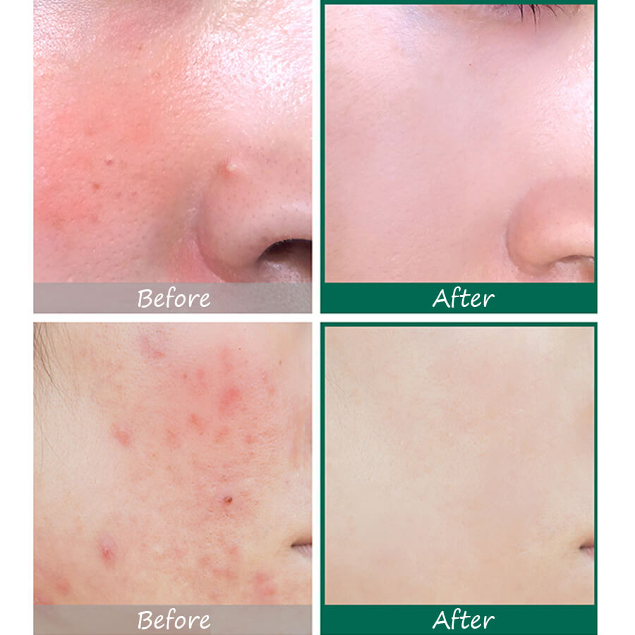 SOME BY MI,SOME BY MI ราคา,SOME BY MI AHA BHA PHA 30 Days Miracle Serum,SOME BY MI AHA BHA PHA 30 Days Miracle Serum ราคา,SOME BY MI AHA BHA PHA 30 Days Miracle Serum รีวิว,SOME BY MI AHA BHA PHA 30 Days Miracle Serum pantip,SOME BY MI AHA BHA PHA 30 Days Miracle Serum twitter